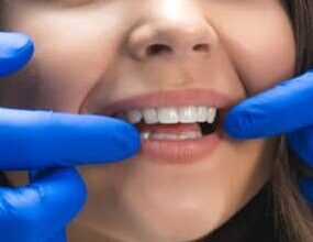 Photo of Cosmetic dentistry in Turkey – the perfect place for a smile makeover!