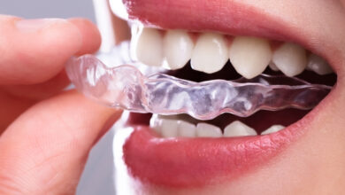 Photo of ما هو التقويم الشفاف للأسنان، أهم المعلومات حوله